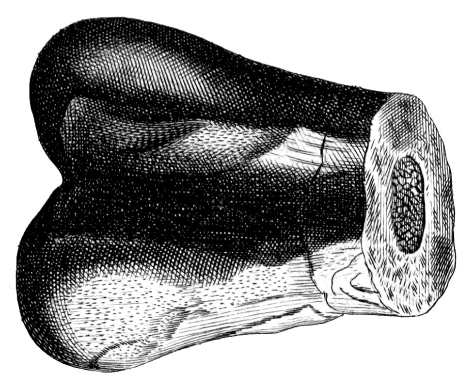 Illustration of a fossilized lower extremity of a presumed Megalosaurus femur