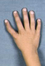 A five-fingered right hand