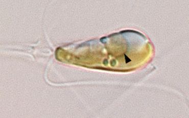 A light microscopy image shows the marine algae Braarudosphaera bigelowii.