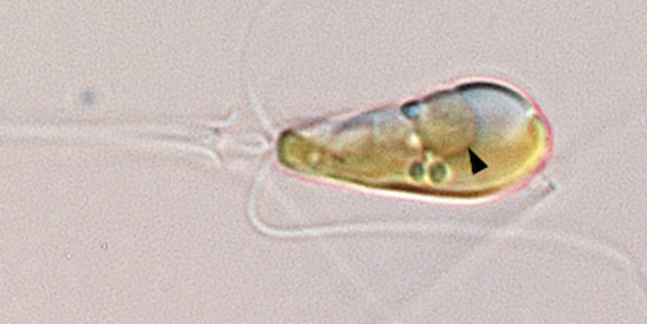 A light microscopy image shows the marine algae Braarudosphaera bigelowii.