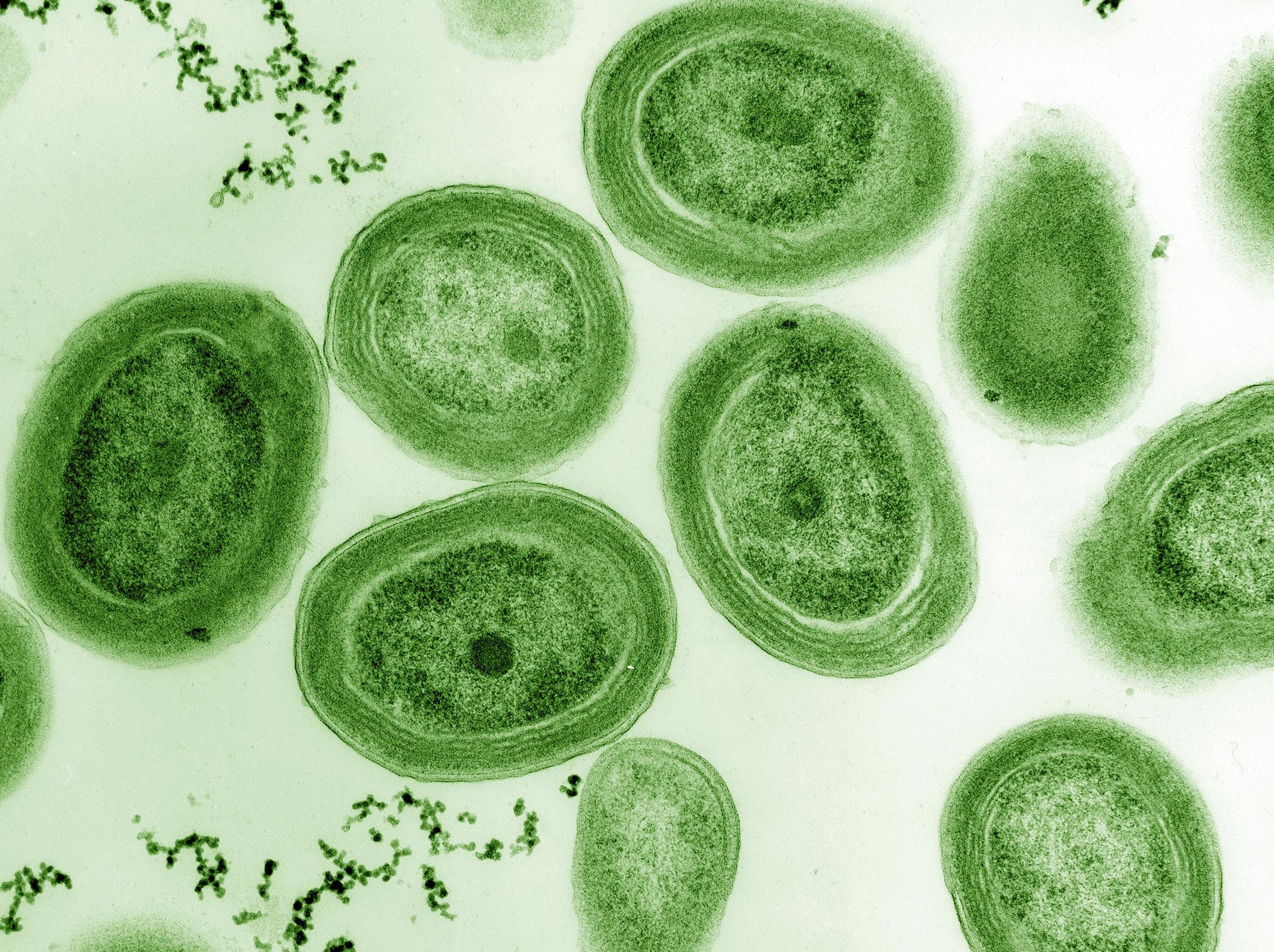 Transmission electron microscopy (TEM) image of Prochlorococcus marinus